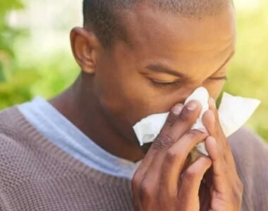 15 Home Remedies for Allergie