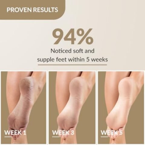 Fixderma Foobetik Cream, Foot cream, Foot care, For Dry & Cracked Feet, Moisturizes & Soothes Feet, Heel Repair, For Calloused, or Chapped Skin, Paraben Free